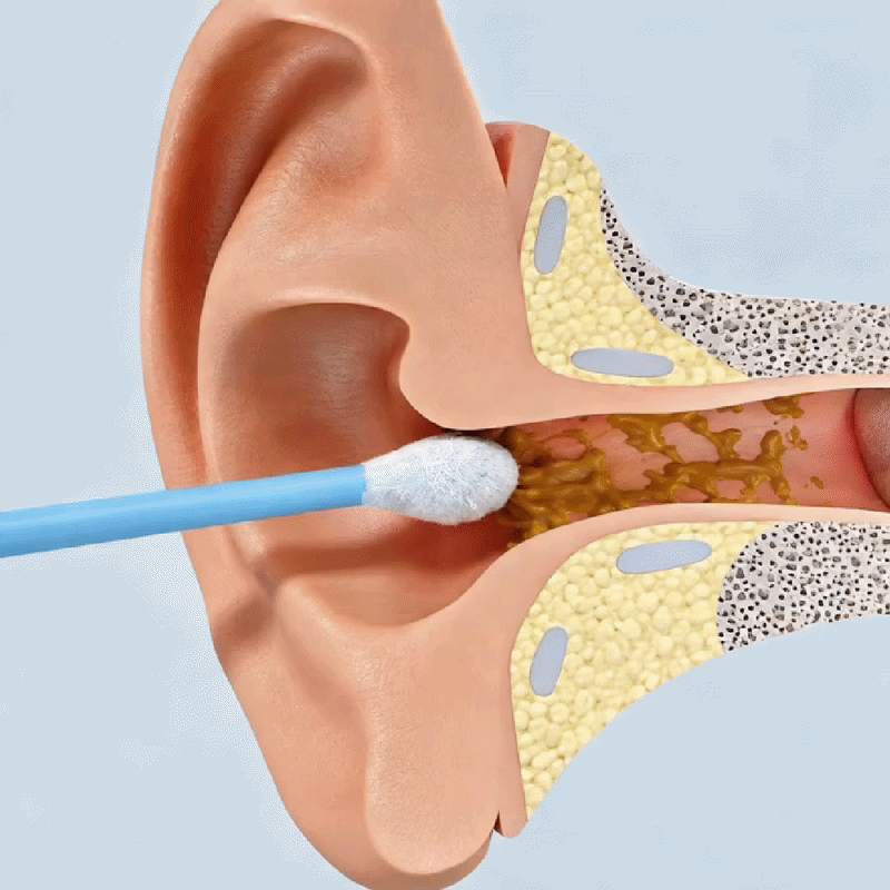 Earsight — Ear Camera & Cleaning Kit