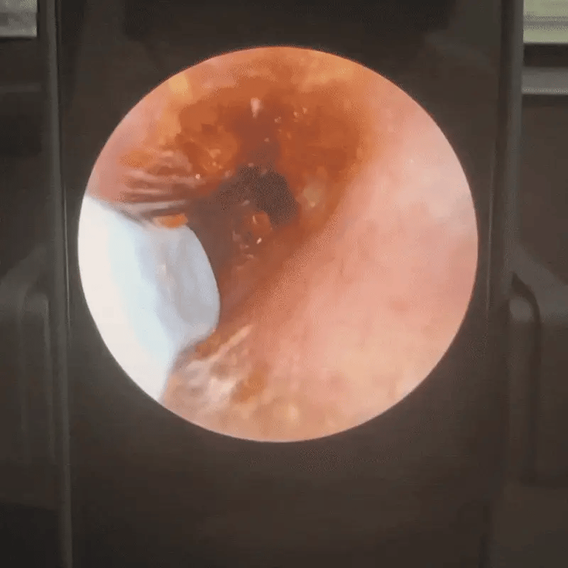 Earsight — Ear Camera & Cleaning Kit